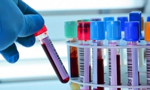 Анализы при обследовании поджелудочной железы позволяют получить информацию не только о заболевании, но и строении органа