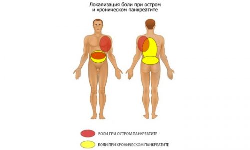 Основной признак панкреатита у мужчин - сильные боли в эпигастральной области. При острой форме заболевания они имеют режущий характер, при хронической - тупой