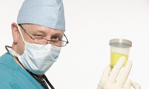 Моча при панкреатите сдается несколько раз, пока человек проходит лечение в стационаре. Результаты биохимического анализа важны, если имеются подозрения на хронический панкреатит